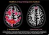 brain-mri-scans.jpg